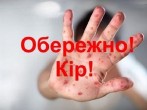 Як розпізнати, що людина заразилася кором? Як розпізнати, що людина заразилася кором?