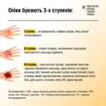 Опіки. Хімічні опіки. Опіки. Хімічні опіки.