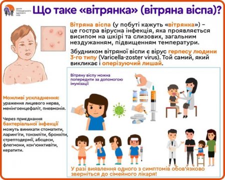 Вітряна віспа або вітрянка: що це за захворювання Вітряна віспа або вітрянка: що це за захворювання